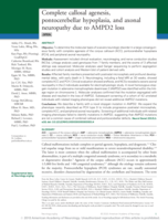 Complete callosal agenesis, pontocerebellar hypoplasia, and axonal neuropathy due to AMPD2 loss
