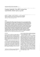 Changing topography of the RPE resulting from experimentally induced rapid eye growth