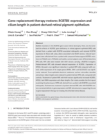 Gene replacement therapy restores RCBTB1 expression and cilium length in patient‐derived retinal pigment epithelium