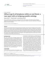 Diffuse large B cell lymphoma within an anal fistula: a case report with an intriguing possible aetiology