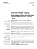 First Cryo-scanning electron microscopy images and X-Ray microanalyses of mucoromycotinian fine root endophytes in vascular plants