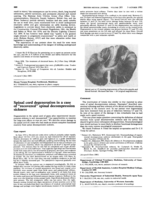 Spinal cord degeneration in a case of "recovered" spinal decompression sickness.