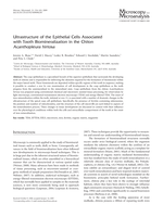 Ultrastructure of the epithelial cells associated with tooth biomineralization in the chiton Acanthopleura hirtosa