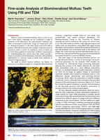 Fine-scale analysis of biomineralized mollusc teeth using FIB and TEM