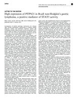 High expression of PTPN21 in B-cell non-Hodgkin’s gastric lymphoma, a positive mediator of STAT5 activity