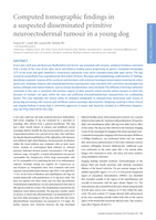 Computed tomographic findings in a suspected disseminated primitive neuroectodermal tumour in a young dog