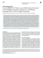 A novel BRD4-NUT fusion in an undifferentiated sinonasal tumor highlights alternative splicing as a contributing oncogenic factor in NUT midline carcinoma