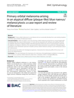 Primary orbital melanoma arising in an atypical diffuse (plaque-like) blue naevus/melanocytosis: a case report and review of literature