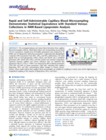 Rapid and Self-Administrable Capillary Blood Microsampling Demonstrates Statistical Equivalence with Standard Venous Collections in NMR-Based Lipoprotein Analysis