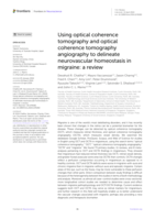 Using optical coherence tomography and optical coherence tomography angiography to delineate neurovascular homeostasis in migraine: a review