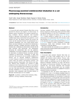 Fluoroscopy-assisted endobronchial intubation in a cat undergoing thoracoscopy